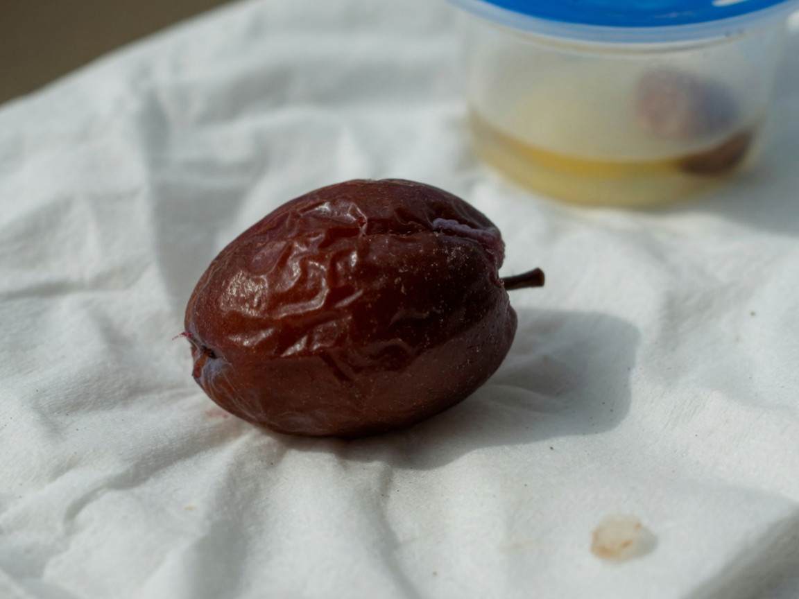 수술 없이 수액과 진통제 치료를 받은 뒤 회복해 병실에서 퇴원을 준비하는 중년 남성 환자의 모습